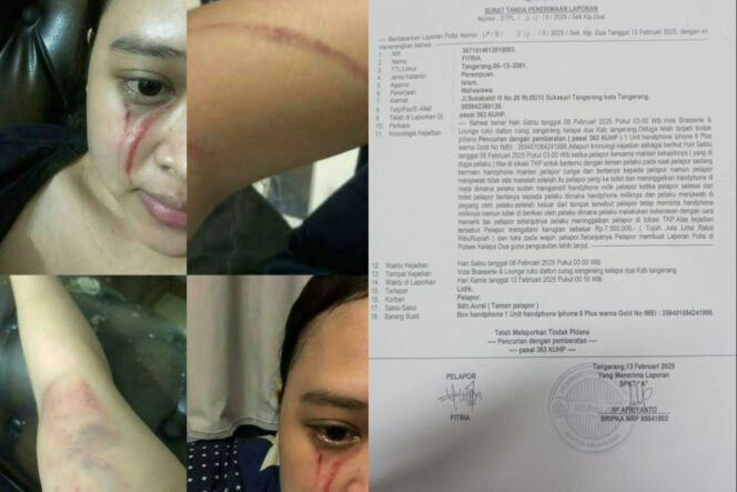 
Korban Lapor Penganiayaan ke Polsek Kelapa Dua, Justru Diancam Dibunuh oleh Mantan Kekasih