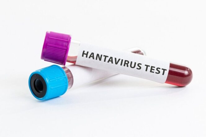 
Waspada Virus Hanta, Kemenkes Catat 8 Kasus HFRS di Indonesia